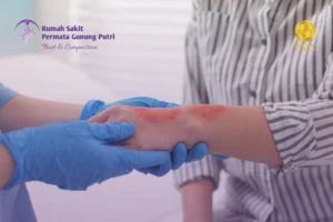 luka bakar akibat minyak panas tidak boleh diberi odol