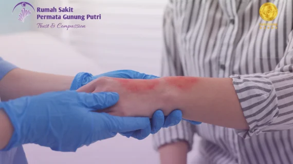 Luka Bakar Dikasih Odol? Kaki Terkilir Langsung Diurut? STOP! Ini Cara Cepat Mengubah Cedera Ringan Jadi Malapetaka