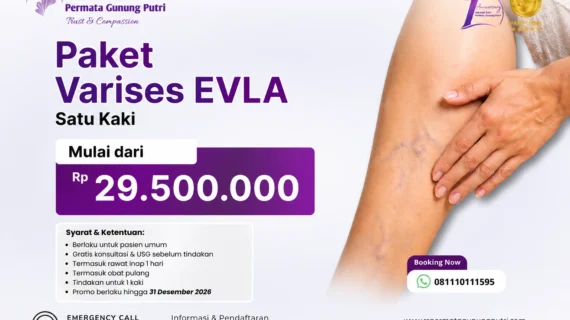 Solusi Modern Bebas VarisesTanpa Operasi Besar di RS Permata Gunung Putri